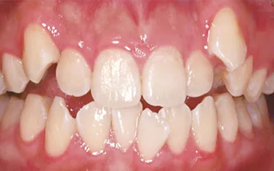 image2